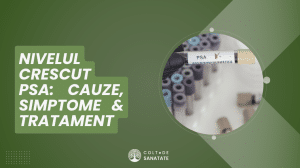 Nivelul Crescut al PSA: Cauze, Simptome & Tratament